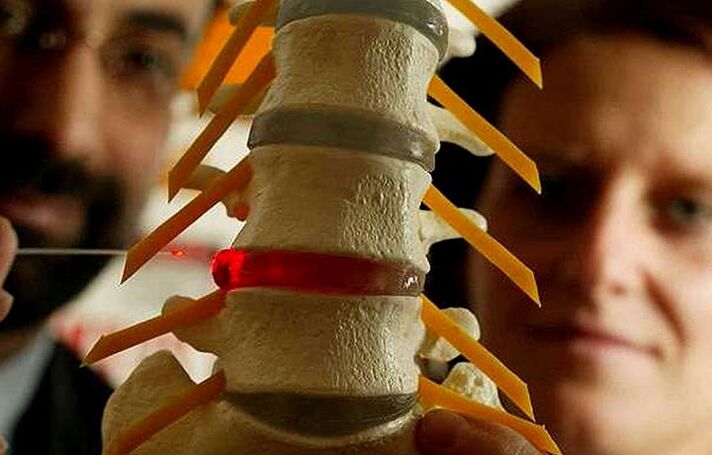 Cambiamenti nell'integrità dei dischi intermedi