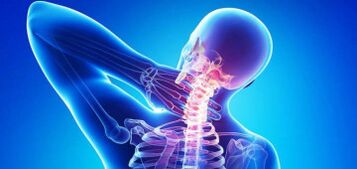 Cause di osteocondosi cervicale