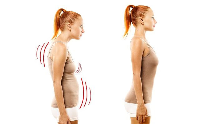 Bug come causa dello sviluppo dell'osteocondosi lombare