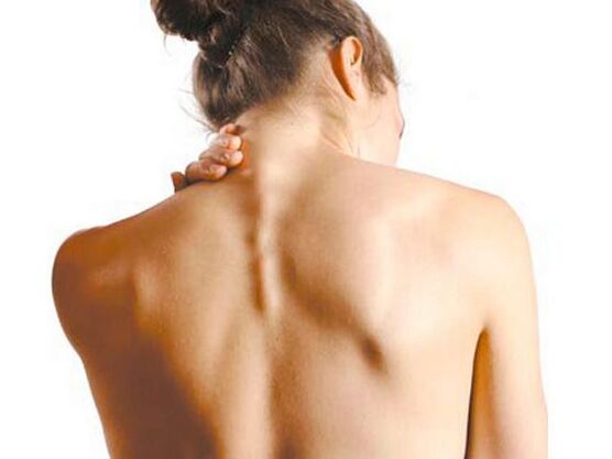 La ragazza soffre di osteocondrosi cervicale