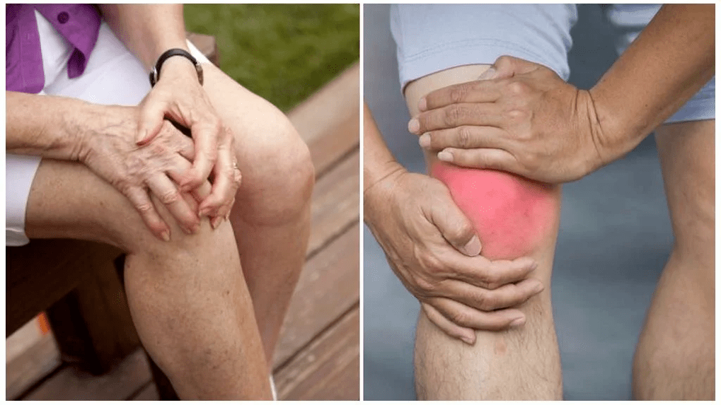 Trattamento dell'osteoartrosi